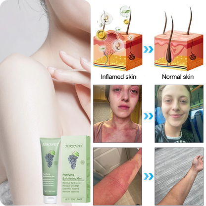 🌲🌲Čistiaci exfoliačný gél na Acanthosis Nigricans, exfoliáciu, tmavé škvrny, kožné štítky a ekzémy✨✨