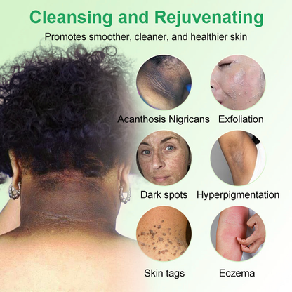 🌲🌲Čistiaci exfoliačný gél na Acanthosis Nigricans, exfoliáciu, tmavé škvrny, kožné štítky a ekzémy✨✨