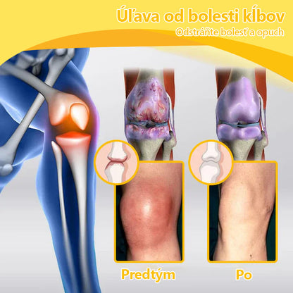 🍀🍀ArthroFree™ Krém proti bolesti kostí s obsahom včelieho jedu🐝(Najmä pre starších dospelých a odporúčané AAOS) x