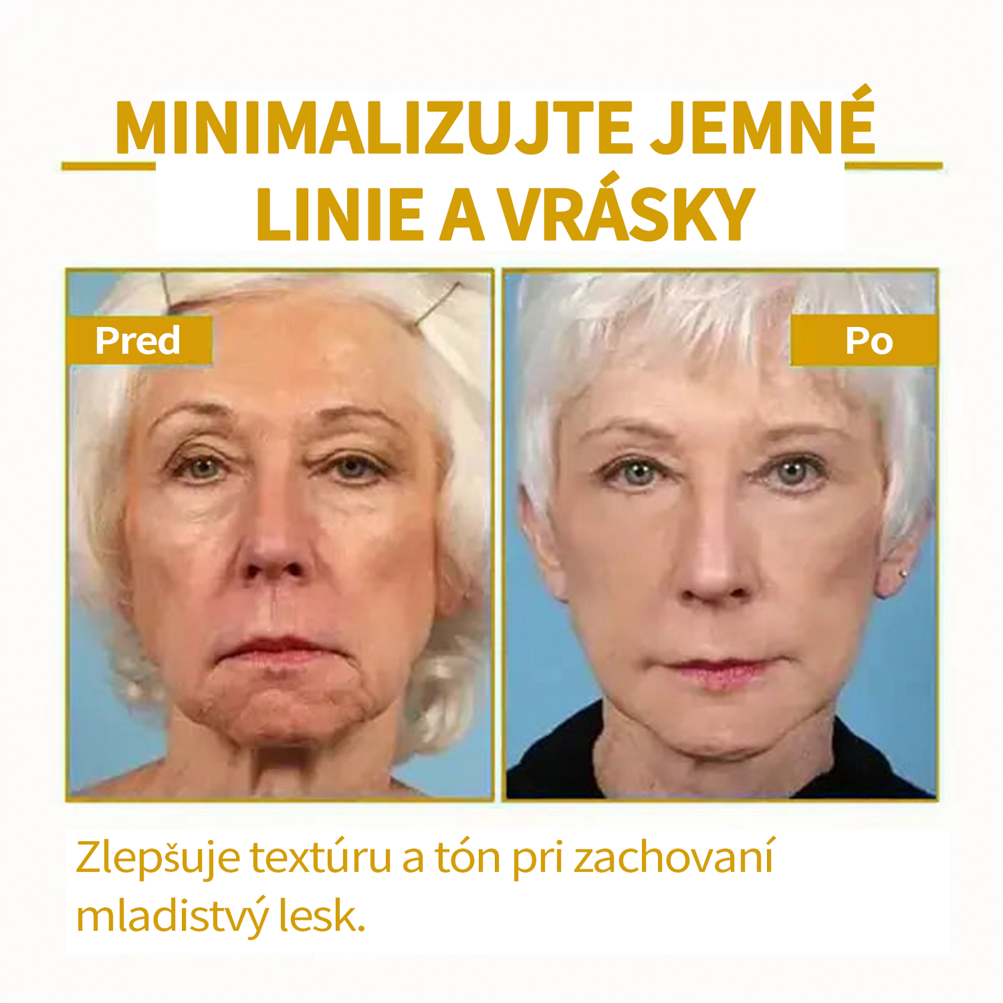 🔥🔥Posledný deň zľava: 70% Zľava Fubsta® SkinFirming Omladzujúci olej