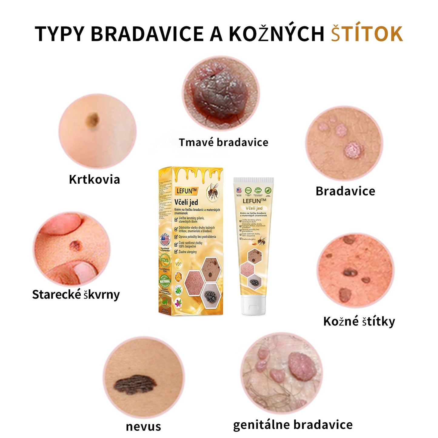 🌈🌈🧴🧴[👑Oficiálny značkový obchod👑] LEFUN™ Krém na ošetrenie krtkov a bradavíc s včelím jedom (👨‍⚕AAD ODPORÚČA)