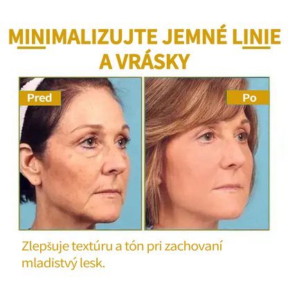 🔥🔥Posledný deň zľava: 70% Zľava Fubsta® SkinFirming Omladzujúci olej