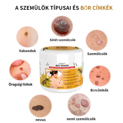 🐝🐝🐝[👑Hivatalos zászlóshajó üzlet👑] Lenaro™ Méhméreg vakond és szemölcs kezelési krém(👨‍⚕AAD AJÁNLJA)