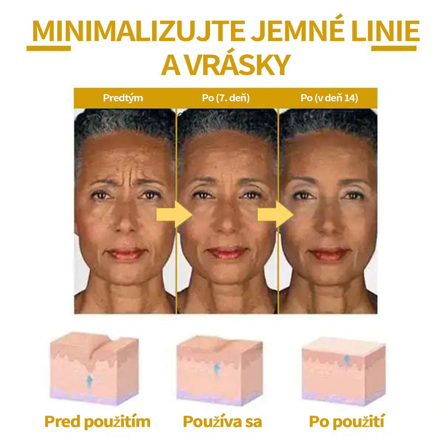 🔥🔥Posledný deň zľava: 70% Zľava Fubsta® SkinFirming Omladzujúci olej