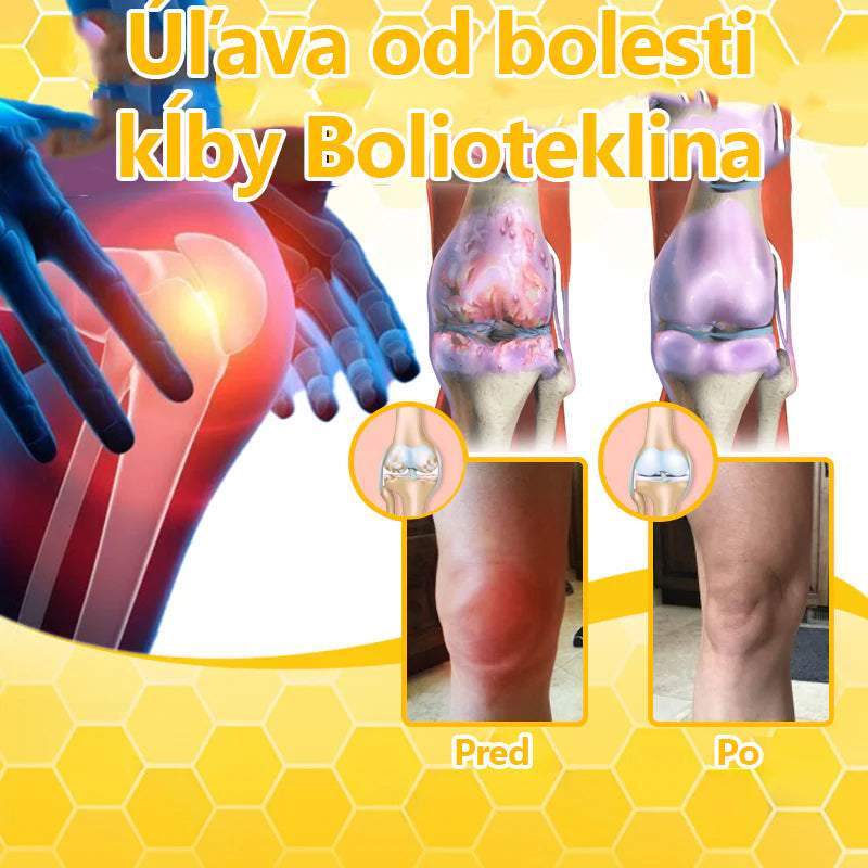 Odstráňte bolesť kĺbov🎁🎁Aeehfeng™ Krém na liečbu artritídy s včelím jedom a kurkumou – 🔥špecializovaný na ortopedické stavy a bolesti kĺbov