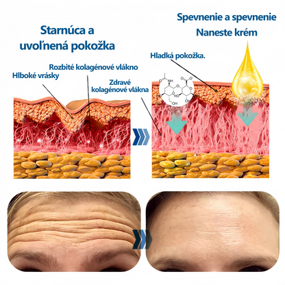 🌈（Posledný deň so zľavou 50 %）Liftingový a spevňujúci krém zo slimačieho kolagénu LENARO™ (🔥🔥🔥 Limitovaná ponuka trvá 30 minút)