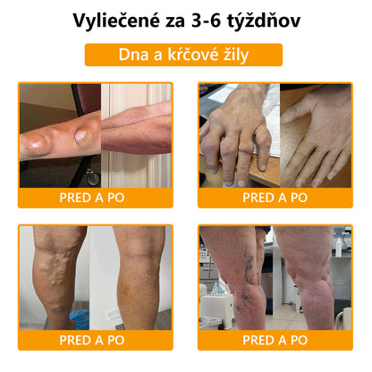 🍀🍀ArthroFree™ Krém proti bolesti kostí s obsahom včelieho jedu🐝(Najmä pre starších dospelých a odporúčané AAOS) x