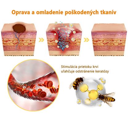 🎉🎉[✨Oficiálny Obchod Značky✨] 𝐙𝐨𝐞𝐧𝐜𝐠𝐳™ Krém na liečbu bradavíc a krtkov so včelím jedom (👨‍⚕𝐀𝐀𝐃 ODPORÚČAME)