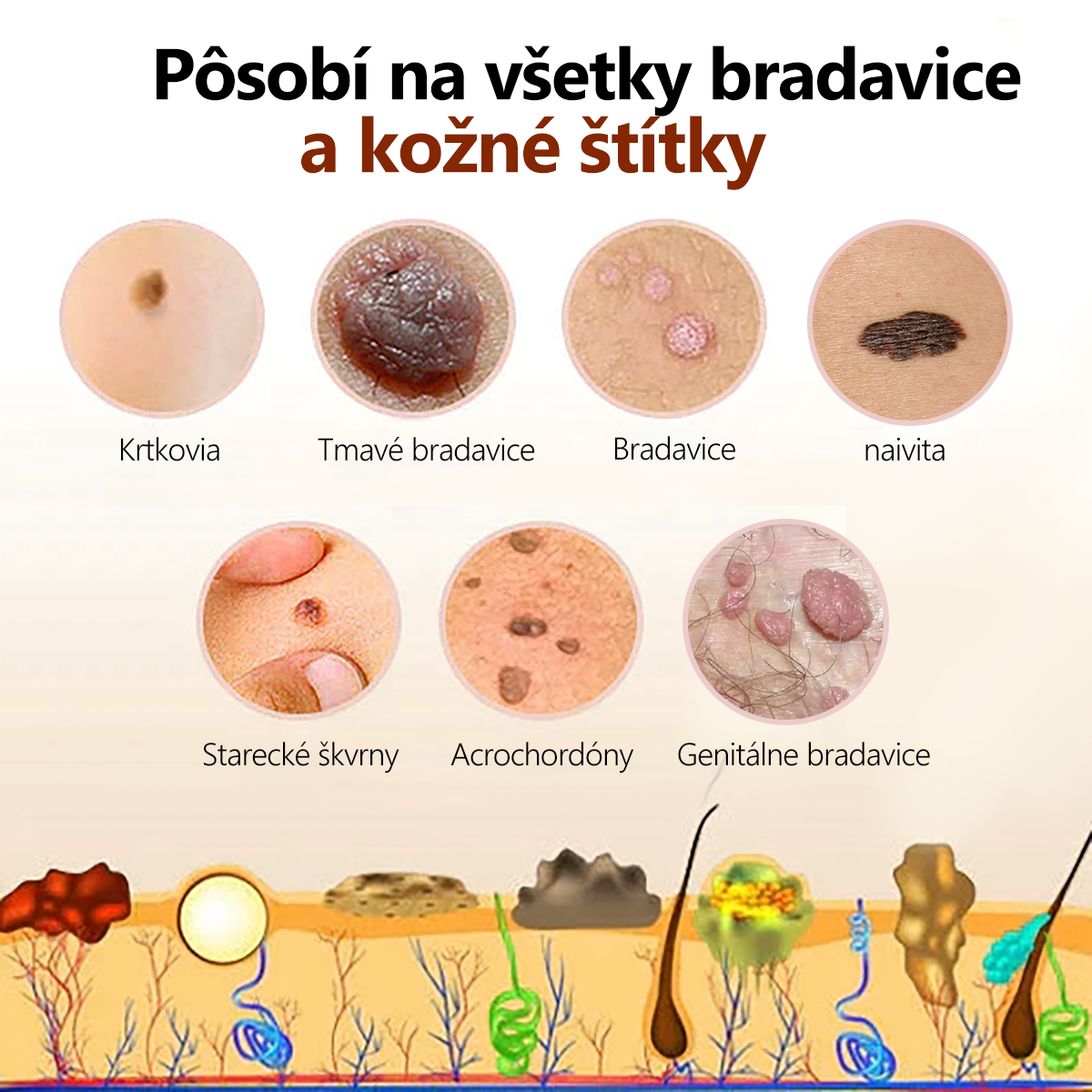 🌐[👑Oficiálny Značkový Obchod👑] Lenaro™ Krém na liečbu bradavíc a krtkov so včelím jedom(👨‍⚕AAD ODPORÚČA)