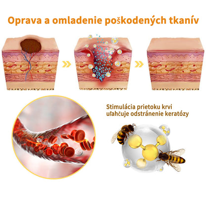 🌈🌈🧴🧴[👑Oficiálny značkový obchod👑] LEFUN™ Krém na ošetrenie krtkov a bradavíc s včelím jedom (👨‍⚕AAD ODPORÚČA)