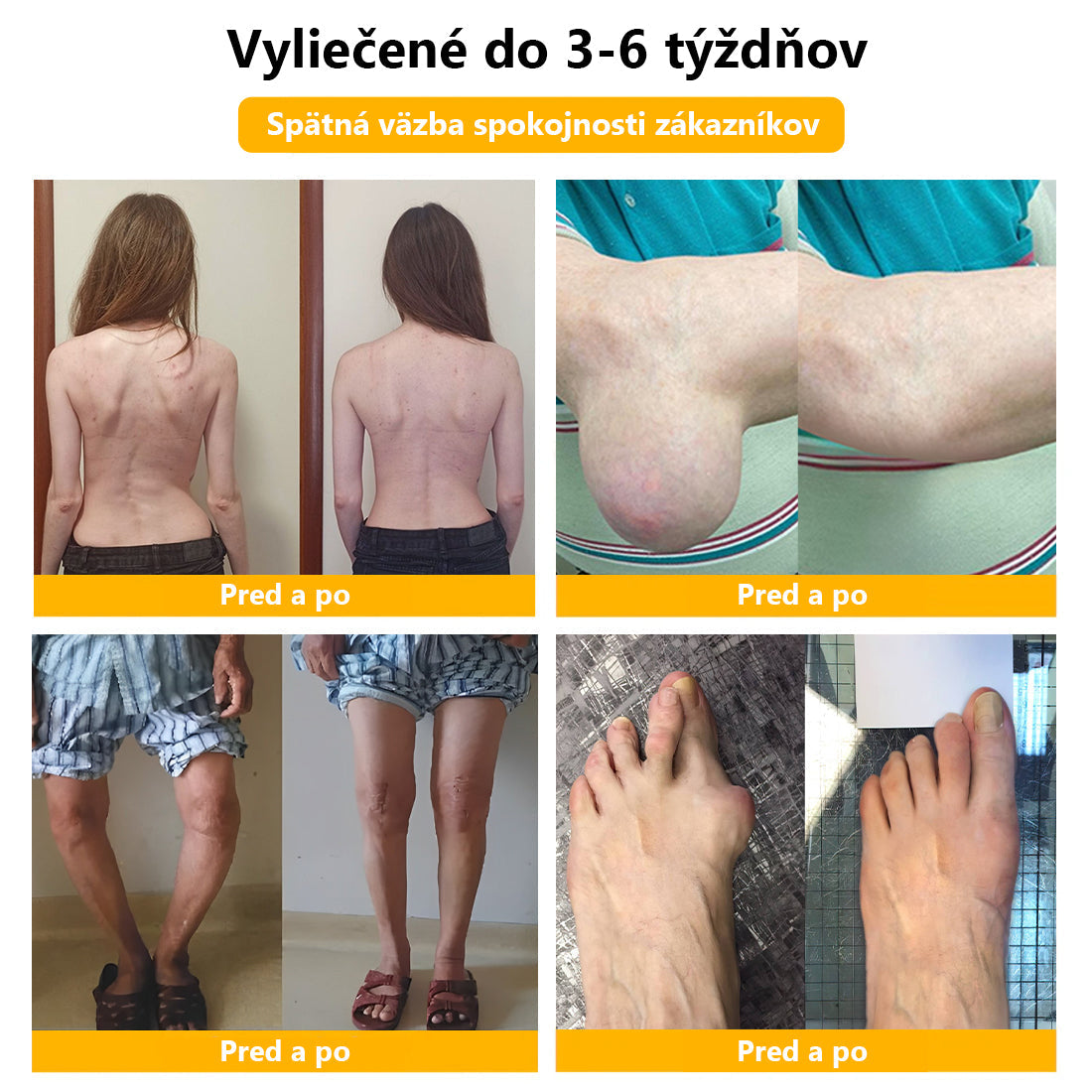 🍀🍀ArthroFree™ Krém proti bolesti kostí s obsahom včelieho jedu🐝(Najmä pre starších dospelých a odporúčané AAOS) x