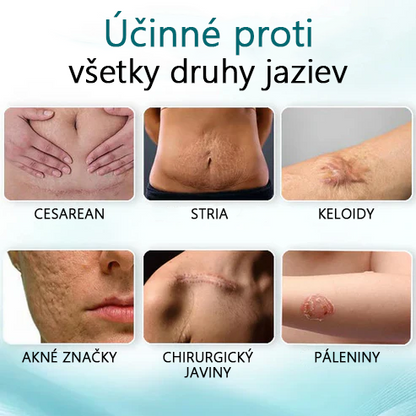 🌿Pokročilý 💧LEFUN™ sprej na jazvy Pre všetky typy jaziev - napríklad jazvy po akné, chirurgické jazvy a strie