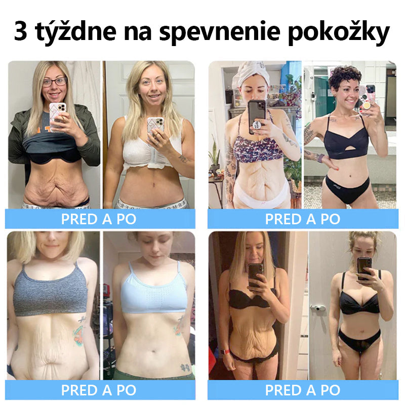 💖💖Flysmus™ Krém na odstraňovanie vrások rieši krepovanie a ochabovanie(🔥75% zľava na obmedzený čas!) x