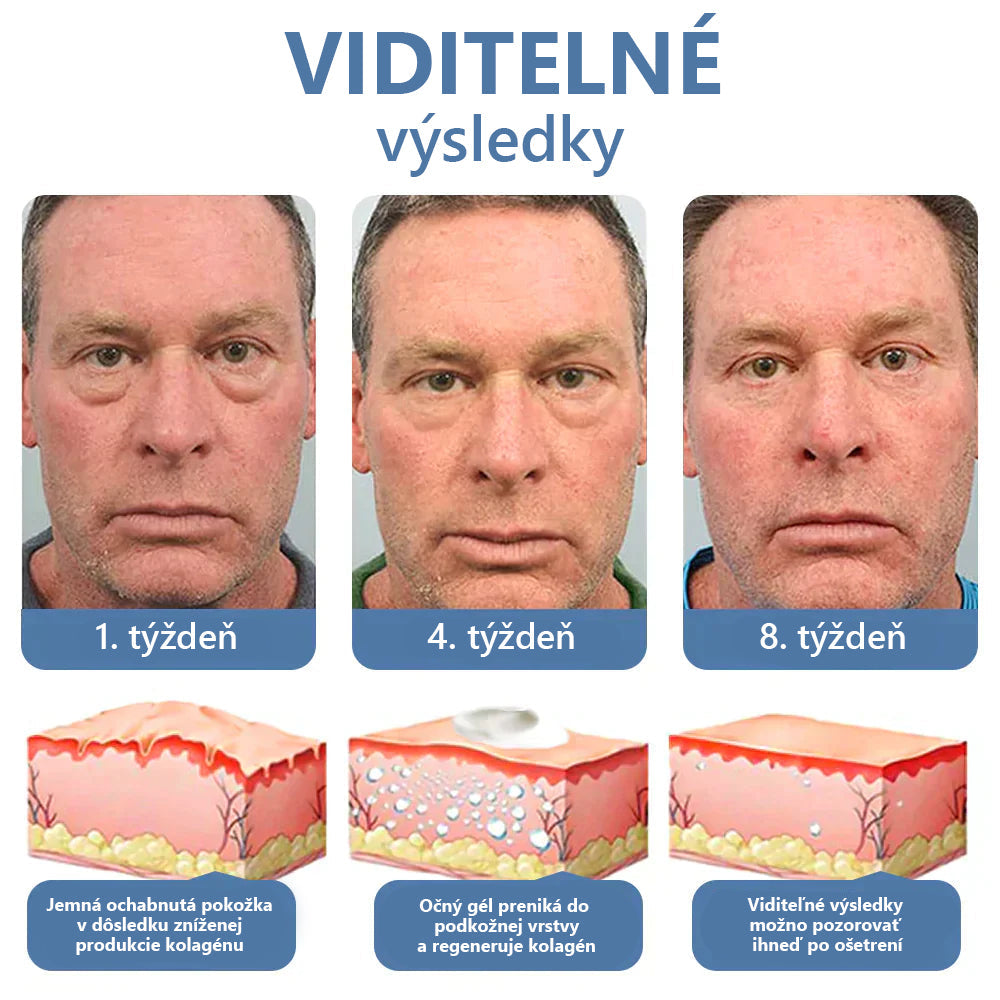 LOVILDS™ 💖 Dr. Gerald Jahr - Slovenské očné centrum Odporúčané produkty: Prebudenie peptidový liftingový očný gél x