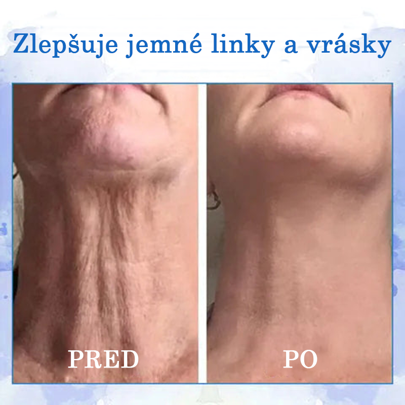 🔥👩‍⚕️𝐋𝐚𝐬𝐭 𝐃𝐚𝐲 𝐃𝐢𝐬𝐜𝐨𝐮𝐧𝐭: 𝟕𝐭: 𝟕🏼 5 % 𝐚® Advanced SkinTightening Rejuvenating Cream: Obnovte pružnosť pokožky💦