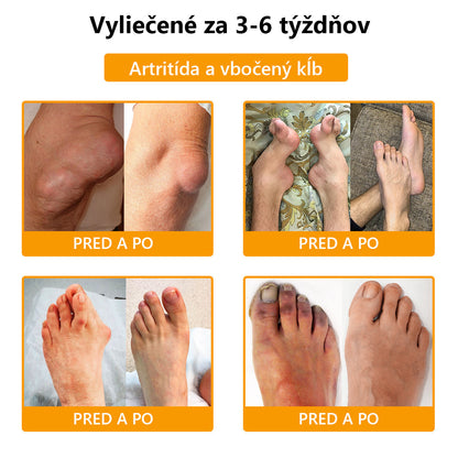 🍀🍀ArthroFree™ Krém proti bolesti kostí s obsahom včelieho jedu🐝(Najmä pre starších dospelých a odporúčané AAOS) x