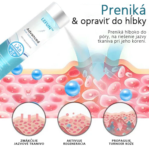 🌿Pokročilý 💧LEFUN™ sprej na jazvy Pre všetky typy jaziev - napríklad jazvy po akné, chirurgické jazvy a strie