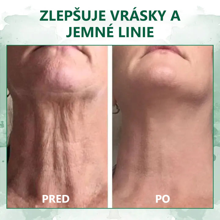 🎉🎉 Posledný deň akcie 70% zľava - Fubsta™ Omladzujúce sérum SkinFirming