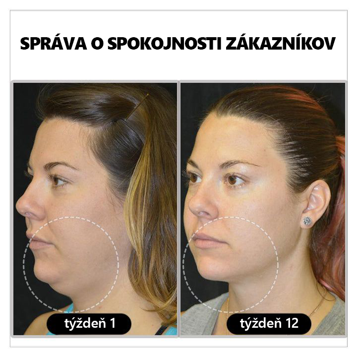 🌸CZTICLE™🌸Magnetológia Lymphvity Germániové náušnice（🔥🔥🔥Posledný deň 50% vypnutie)1