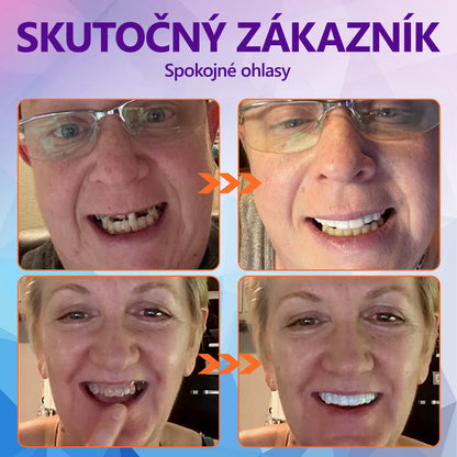 Sada silikónových vankúšikov na zubné protézy (⏰ Časovo obmedzená zľava Posledných 30 minút ⏰)x 𝐁𝐢𝐤𝐞𝐧𝐝𝐚™🦷