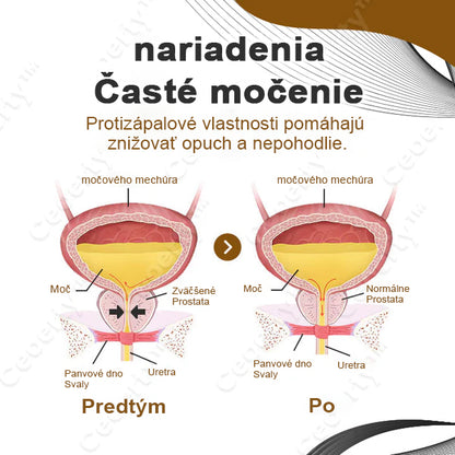 Ceoerty™ ProstaVeno Nosový Sprej na Starostlivosť o Prostatu