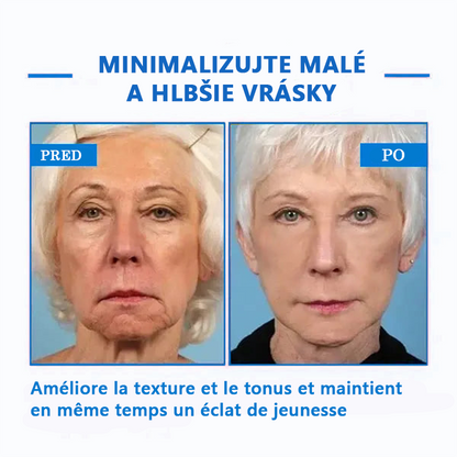 🔥👩‍⚕️𝐋𝐚𝐬𝐭 𝐃𝐚𝐲 𝐃𝐢𝐬𝐜𝐨𝐮𝐧𝐭: 𝟕𝐭: 𝟕🏼 5 % 𝐚® Advanced SkinTightening Rejuvenating Cream: Obnovte pružnosť pokožky💦