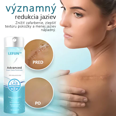 🌿Pokročilý 💧LEFUN™ sprej na jazvy Pre všetky typy jaziev - napríklad jazvy po akné, chirurgické jazvy a strie