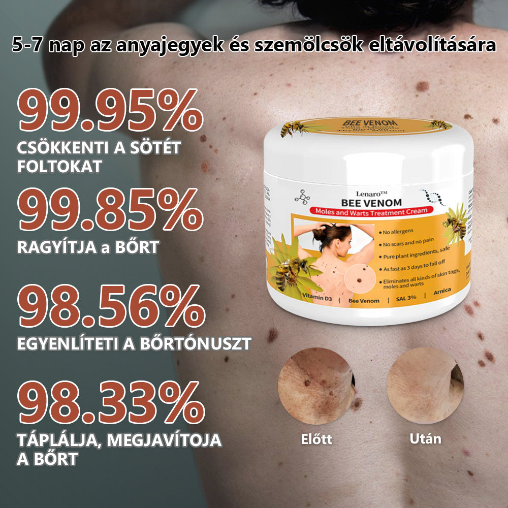 🐝🐝🐝[👑Hivatalos zászlóshajó üzlet👑] Lenaro™ Méhméreg vakond és szemölcs kezelési krém(👨‍⚕AAD AJÁNLJA)