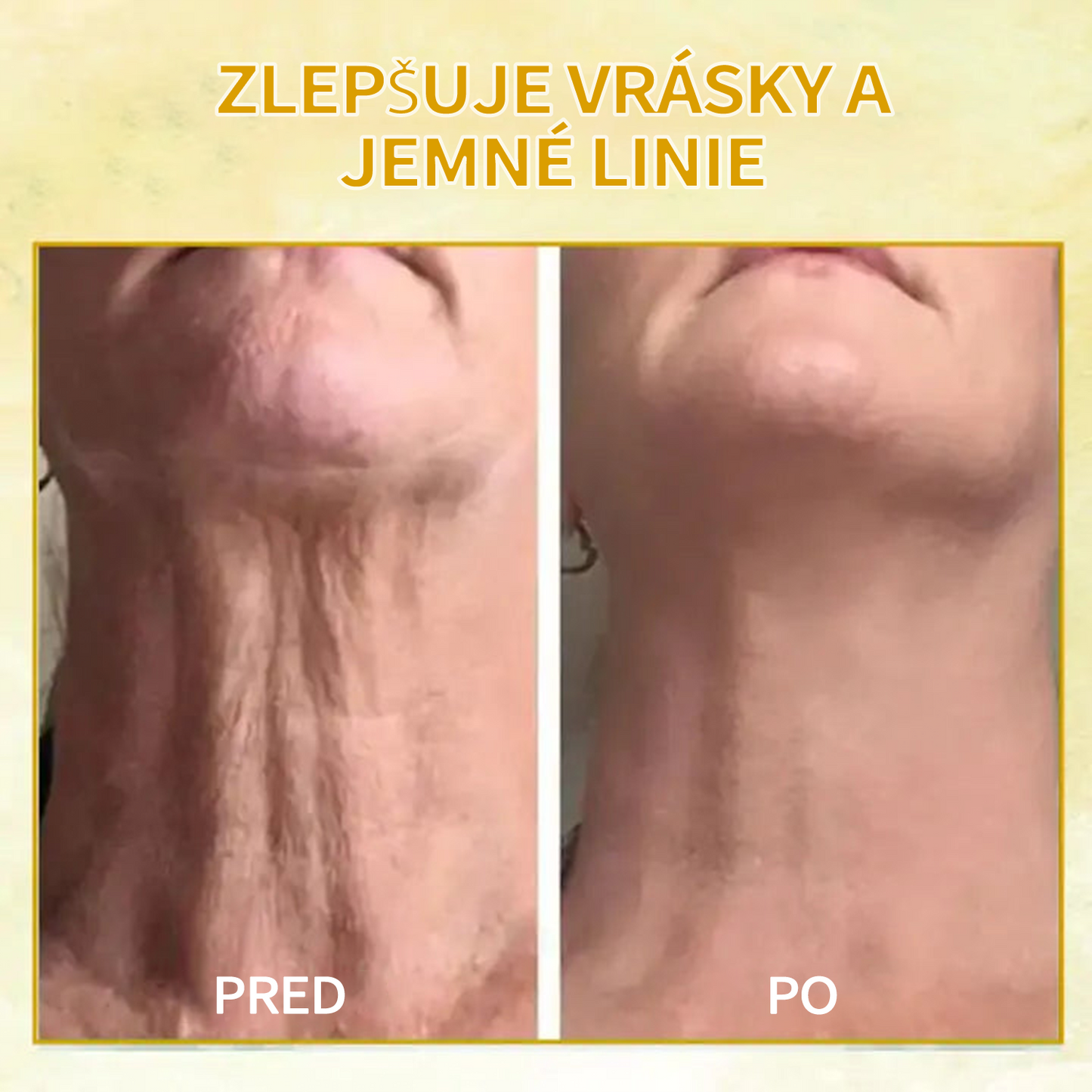 🍀🍀Zľava na posledný deň: 70% zľava 🐝LEFUN® Luxusný spevňujúci esenciálny olej pre mladých x