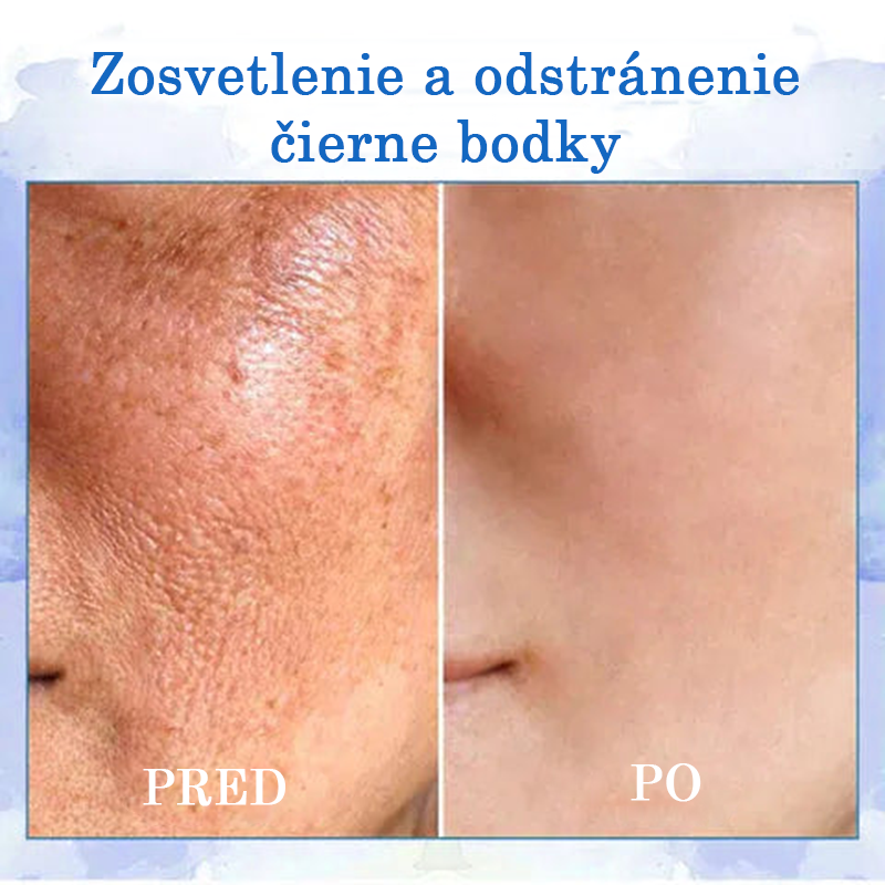 🔥👩‍⚕️𝐋𝐚𝐬𝐭 𝐃𝐚𝐲 𝐃𝐢𝐬𝐜𝐨𝐮𝐧𝐭: 𝟕𝐭: 𝟕🏼 5 % 𝐚® Advanced SkinTightening Rejuvenating Cream: Obnovte pružnosť pokožky💦