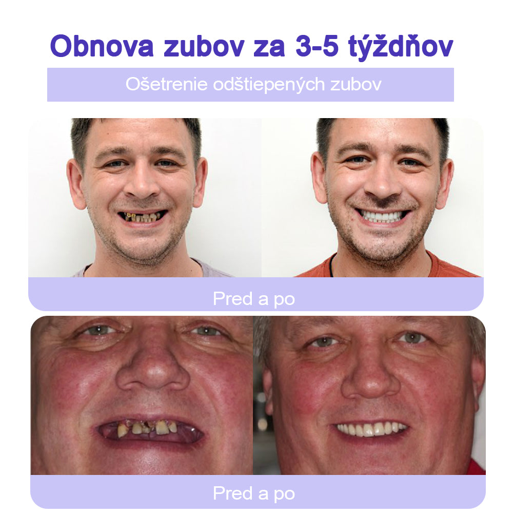 GarageLine™ (odporúčaný ADA) Minerálny prášok na obnovu zubov (⏰Obmedzená časová zľava, posledných 30 minút⏰) 🪥🦷