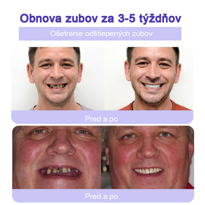 GarageLine™ (odporúčaný ADA) Minerálny prášok na obnovu zubov (⏰Obmedzená časová zľava, posledných 30 minút⏰) 🪥🦷