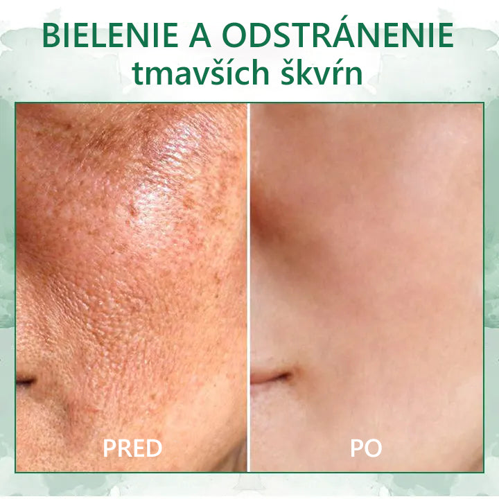 🎉🎉 Posledný deň akcie 70% zľava - Fubsta™ Omladzujúce sérum SkinFirming