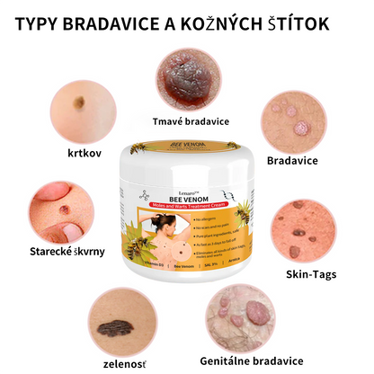 🌐[👑Oficiálny Značkový Obchod👑] Lenaro™ Krém na liečbu bradavíc a krtkov so včelím jedom(👨‍⚕AAD ODPORÚČA)