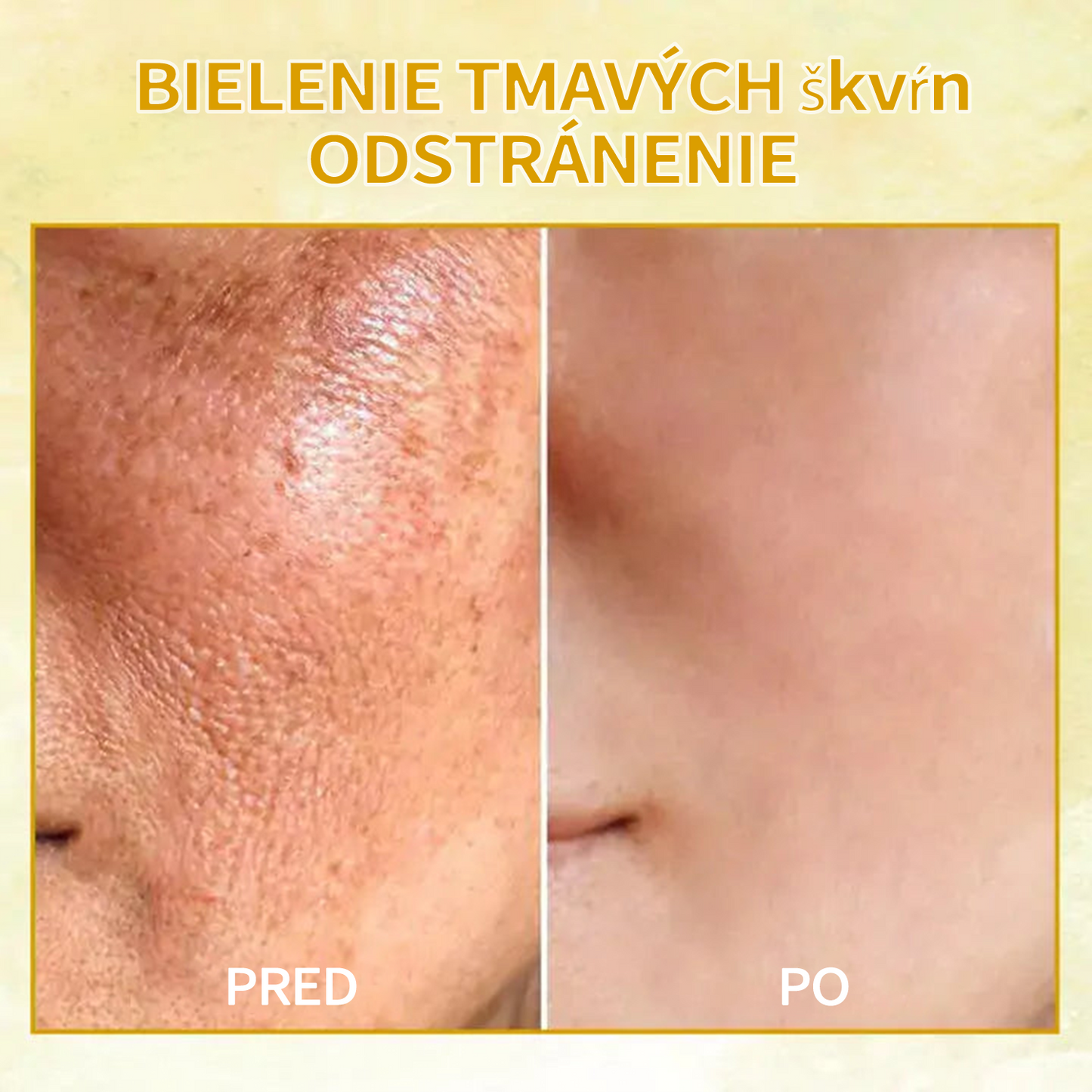 🍀🍀Zľava na posledný deň: 70% zľava 🐝LEFUN® Luxusný spevňujúci esenciálny olej pre mladých x