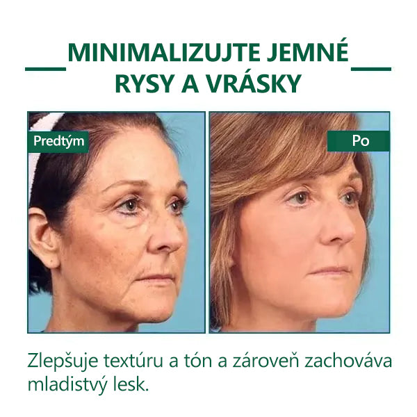 🎉🎉 Posledný deň akcie 70% zľava - Fubsta™ Omladzujúce sérum SkinFirming