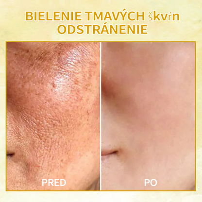 🔥🔥Posledný deň zľava: 70% Zľava Fubsta® SkinFirming Omladzujúci olej