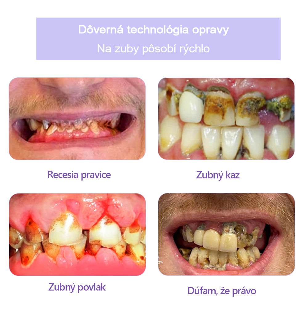 GarageLine™ (odporúčaný ADA) Minerálny prášok na obnovu zubov (⏰Obmedzená časová zľava, posledných 30 minút⏰) 🪥🦷