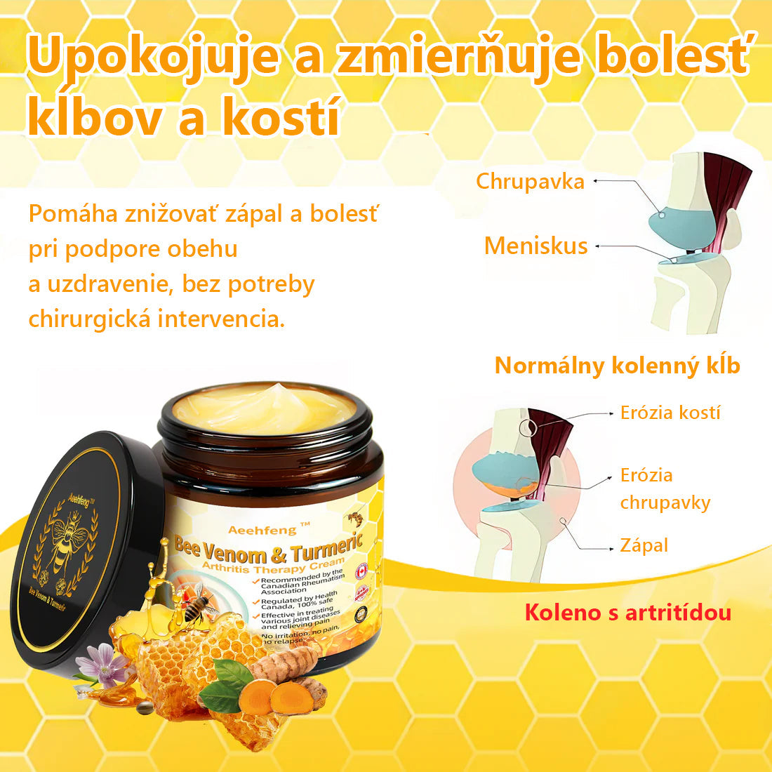 Odstráňte bolesť kĺbov🎁🎁Aeehfeng™ Krém na liečbu artritídy s včelím jedom a kurkumou – 🔥špecializovaný na ortopedické stavy a bolesti kĺbov