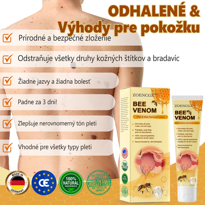 🎉🎉[✨Oficiálny Obchod Značky✨] 𝐙𝐨𝐞𝐧𝐜𝐠𝐳™ Krém na liečbu bradavíc a krtkov so včelím jedom (👨‍⚕𝐀𝐀𝐃 ODPORÚČAME)